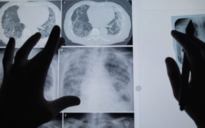 Opinion: How my cancer diagnosis changed the way I train physicians